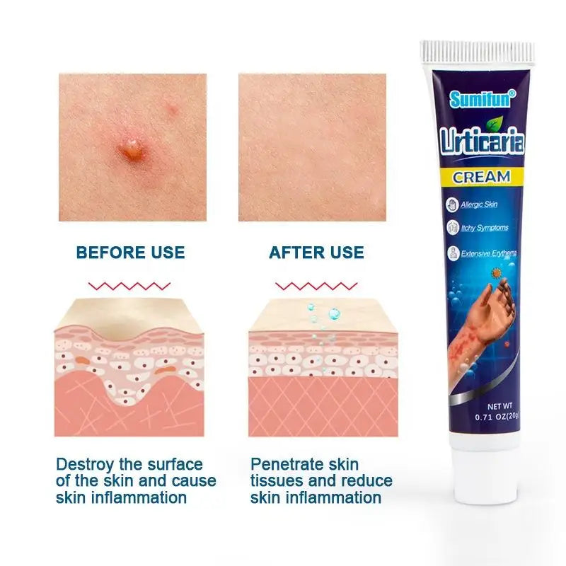 Natural urticaria jade skin antipruritic cream